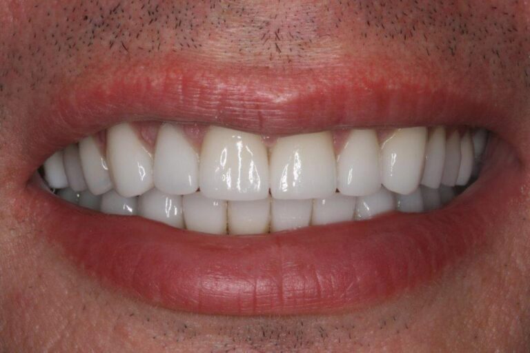 Konig Center for Cosmetic & Comprehensive Dentistry smile photos